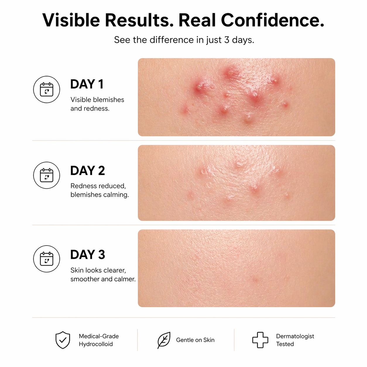 Lanzarosa Hydrocolloid Roll