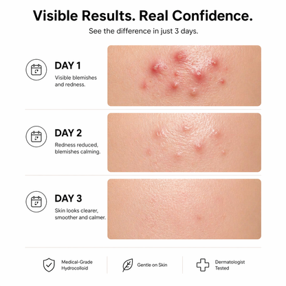 Lanzarosa Hydrocolloid Roll